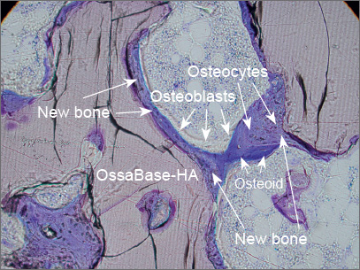 Histologischer Schnitt: OssaBase-HA mit neu gebildetem Knochen