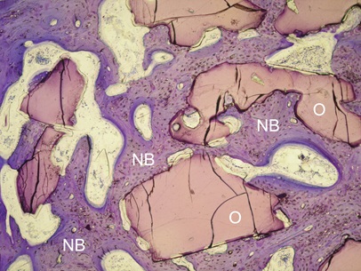 Histologischer Schnitt: OssaBase-HA mit neu gebildetem Knochen