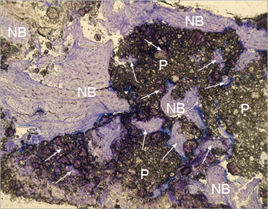 Histologischer Schnitt: Porenstruktur von PORESORB-TCP
